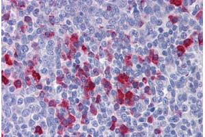 Immunohistochemistry (Formalin-fixed Paraffin-embedded Sections) (IHC (fp)) image for anti-Adaptor Protein, phosphotyrosine Interaction, PH Domain and Leucine Zipper Containing 1 (APPL1) (AA 467-516) antibody (ABIN6747166)