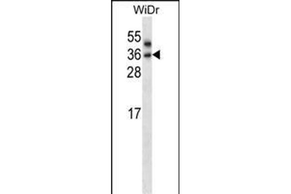 PNPLA4 Antikörper  (C-Term)
