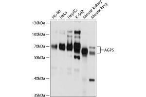 Western blot analysis of extracts of various cell lines, using AGPS antibody (ABIN6129641, ABIN6136644, ABIN6136645 and ABIN6214756) at 1:1000 dilution. (AGPS Antikörper  (AA 379-658))
