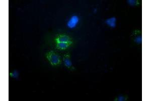 Anti-CALCOCO2 mouse monoclonal antibody (ABIN2453920) immunofluorescent staining of COS7 cells transiently transfected by pCMV6-ENTRY CALCOCO2 (RC203843). (CALCOCO2 Antikörper)
