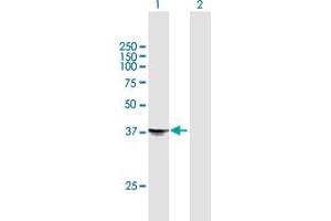 Western Blot analysis of STX18 expression in transfected 293T cell line by STX18 MaxPab polyclonal antibody. (Syntaxin 18 Antikörper  (AA 1-335))