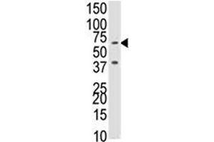 Western blot analysis of BMPR1B antibody and NCI-H460 cell lysate.