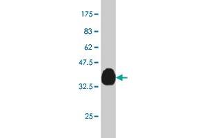 Western Blot detection against Immunogen (37.