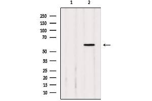 Western blot analysis of extracts from mouse kidney, using Catalase Antibody.