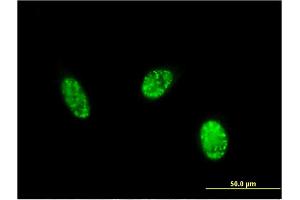 Immunofluorescence of monoclonal antibody to EXOSC1 on HeLa cell. (EXOSC1 Antikörper  (AA 1-195))