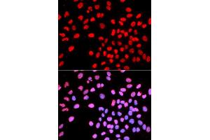 Immunofluorescence analysis of U2OS cells using IKZF1 antibody (ABIN5970949). (IKZF1 Antikörper)