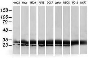 Image no. 3 for anti-Haloacid Dehalogenase-Like Hydrolase Domain Containing 1 (HDHD1) antibody (ABIN1498622) (HDHD1 Antikörper)