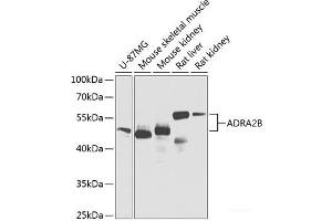 Western blot analysis of extracts of various cell lines using ADRA2B Polyclonal Antibody at dilution of 1:1000. (ADRA2B Antikörper)