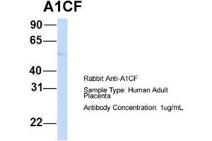 Host:  Rabbit  Target Name:  A1CF  Sample Type:  Human Adult Placenta  Antibody Dilution:  1. (A1CF Antikörper  (N-Term))