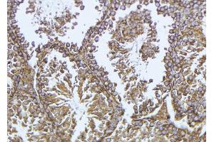 ABIN6276964 at 1/100 staining Mouse testis tissue by IHC-P.