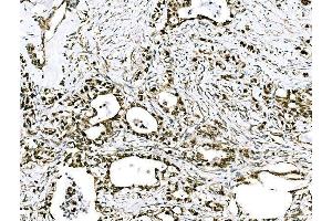 IHC analysis of GRHL2 using anti-GRHL2 antibody (ABIN7599505).