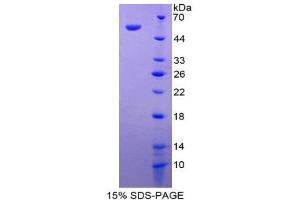 SDS-PAGE (SDS) image for Cell Death-Inducing DFFA-Like Effector A (CIDEA) (AA 1-219) protein (His tag,GST tag) (ABIN1981229) (CIDEA Protein (AA 1-219) (His tag,GST tag))