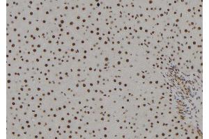 ABIN6279378 at 1/100 staining Rat liver tissue by IHC-P.