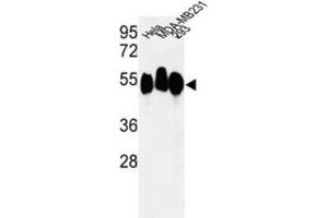 Western Blotting (WB) image for anti-Retinoblastoma Binding Protein 7 (RBBP7) antibody (ABIN3003931) (RBBP7 Antikörper)