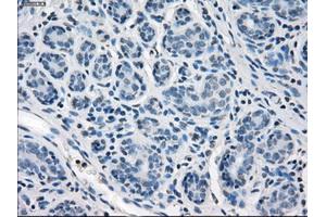 Immunohistochemical staining of paraffin-embedded breast tissue using anti-SLC2A5 mouse monoclonal antibody. (SLC2A5 Antikörper)