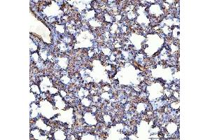 IHC analysis of ACE using anti-ACE antibody (ABIN3043777).