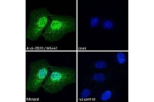 Immunofluorescence (IF) image for anti-Membrane-Spanning 4-Domains, Subfamily A, Member 1 (MS4A1) (C-Term) antibody (ABIN570905)