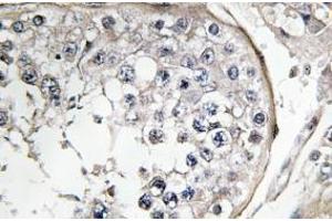 Image no. 1 for anti-Phosphoinositide 3 Kinase, p85 alpha (PI3K p85a) antibody (ABIN317803) (PIK3R1 Antikörper)