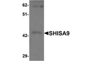 Western blot analysis of SHISA9 in rat brain tissue lysate with SHISA9 antibody at 1 μg/ml. (Shisa9 Antikörper  (Center))