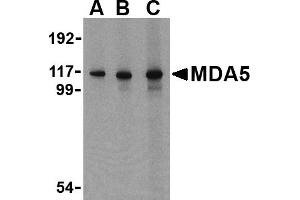 Western blot analysis of MDA5 in Daudi cell lysate with MDA5 antibody at (A) 1, (B) 2 and (C) 4 µg/mL. (IFIH1 Antikörper  (C-Term))
