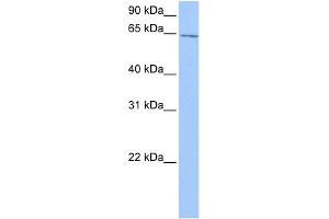 WB Suggested Anti-C2orf42 Antibody Titration: 0. (C2orf42 Antikörper  (C-Term))