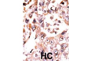 Immunohistochemistry (IHC) image for anti-Dual Specificity Phosphatase 3 (DUSP3) antibody (ABIN3003774) (Dual Specificity Phosphatase 3 (DUSP3) Antikörper)
