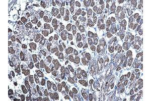 Immunohistochemistry (IHC) image for anti-Mechanistic Target of Rapamycin (serine/threonine Kinase) (mTOR) (C-Term) antibody (ABIN2855088)