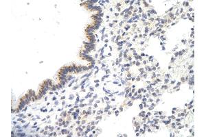 Rabbit Anti-VDAC3 antibody Catalog Number: ARP35180_P050  Paraffin Embedded Tissue: Human Lung cell  Cellular Data: Epithelial cells of renal tubule Antibody Concentration:  4. (VDAC3 Antikörper  (N-Term))