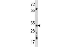 AMPK beta 2 antibody western blot analysis in mouse kidney tissue lysate (PRKAB2 Antikörper  (AA 3-33))