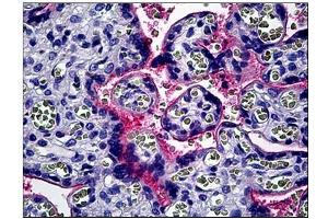 Human Placenta: Formalin-Fixed, Paraffin-Embedded (FFPE) (CD51 Antikörper  (C-Term))