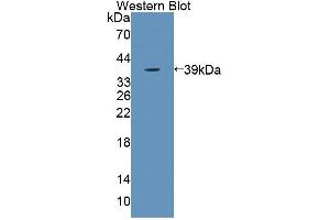 Western blot analysis of the recombinant protein. (KEL Antikörper  (AA 49-358))