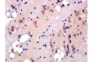 Formalin-fixed and paraffin embedded rat brain labeled with Rabbit Anti-5HT2A Receptor/SR-2A Polyclonal Antibody, Unconjugated (ABIN1386671) at 1:200 followed by conjugation to the secondary antibody and DAB staining (HTR2A Antikörper  (AA 51-150))