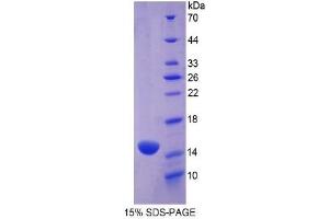 SDS-PAGE (SDS) image for Myeloperoxidase (MPO) ELISA Kit (ABIN6574172)
