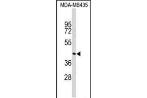 Western blot analysis of PHYH Antibody in MDA-MB435 cell line lysates (35ug/lane) (PHYH Antikörper  (N-Term))