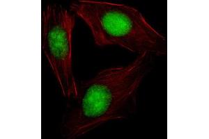 Immunofluorescence (IF) image for anti-Sterol Regulatory Element Binding Transcription Factor 2 (SREBF2) antibody (ABIN2995769) (SREBF2 Antikörper)