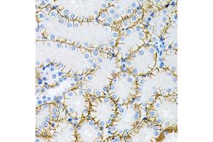 Immunohistochemistry of paraffin-embedded mouse kidney using Tau antibody (ABIN3021441, ABIN3021442, ABIN3021443 and ABIN6215045) at dilution of 1:100 (40x lens). (MAPT Antikörper  (AA 1-100))