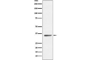 Western blot analysis of SIRT5 expression in HeLa cell lysate.