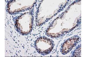 Immunohistochemical staining of paraffin-embedded Human prostate tissue using anti-SEC14L2 mouse monoclonal antibody. (SEC14L2 Antikörper)