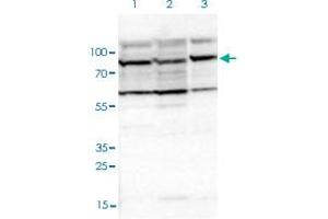 Western blot analysis of Lane 1: Human cell line RT-4; Lane 2: Human cell line U-251MG sp; Lane 3: Human plasma (IgG/HSA depleted) with EIF4ENIF1 polyclonal antibody  at 1:100-1:250 dilution. (EIF4ENIF1 Antikörper)