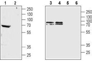 Western blot analysis of rat brain membrane (lanes 1 and 2), mouse brain membrane (lane 3 and 5) and SH-SY5Y cell lysate (lanes 4 and 6): - 1,3,4. (CHRM4 Antikörper  (3rd Intracellular Loop))