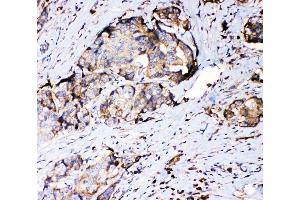 IHC analysis of RPSA using anti-RPSA antibody (ABIN4886715).
