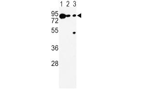 Western Blotting (WB) image for anti-Dopachrome Tautomerase (DCT) antibody (ABIN3003902) (DCT Antikörper)