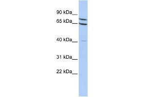 WB Suggested Anti-ZNF471 Antibody Titration:  0. (ZNF471 Antikörper  (N-Term))