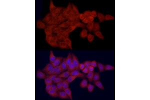 Immunofluorescence analysis of HeLa cells using SLC27 Rabbit pAb (2847) at dilution of 1:100 (40x lens). (SLC27A1 Antikörper  (AA 347-646))