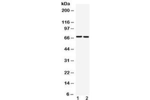 Western blot testing of 1) rat liver and 2) human A549 cell lysate with GAA antibody at 0. (GAA Antikörper  (AA 494-527))