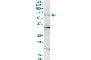 CSGALNACT2 MaxPab rabbit polyclonal antibody. (CSGALNACT2 Antikörper  (AA 1-542))