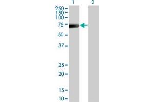 Western Blot analysis of KRT5 expression in transfected 293T cell line by KRT5 monoclonal antibody (M08), clone 1A12. (Cytokeratin 5 Antikörper  (AA 1-590))