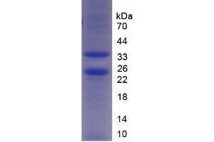 Image no. 1 for Mps1 (TTK) (AA 527-786) protein (His tag) (ABIN6238123) (Mps1 Protein (TTK) (AA 527-786) (His tag))
