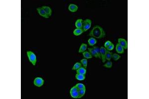 Immunofluorescent analysis of PC-3 cells using ABIN7169234 at dilution of 1:100 and Alexa Fluor 488-congugated AffiniPure Goat Anti-Rabbit IgG(H+L) (WNK4 Antikörper  (AA 828-1106))