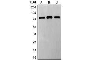Western blot analysis of Frizzled 8 expression in HeLa (A), Jurkat (B), MCF7 (C) whole cell lysates.